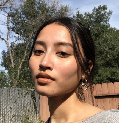 After non-surgical nose job